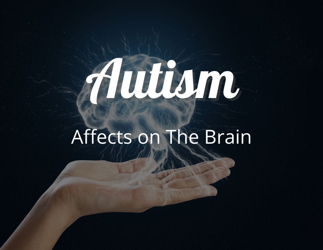 What Parts of the Brain Does Autism Affect